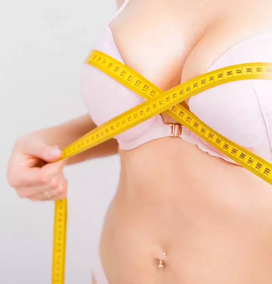 Na imagem, observa-se uma mulher vista de perfil pelo lado esquerdo, com idades na faixa dos 30 anos, que se submeteu a uma cirurgia de redução mamária com objetivo de diminuir o volume da mama e melhorar a proporção corporal, um procedimento médico que proporciona alívio em sintomas como dor nas costas e desconforto habitual causado pelo peso excessivo do tecido mamário. Este tipo de intervenção é altamente regulado e executado por profissionais qualificados em cirurgia plástica.